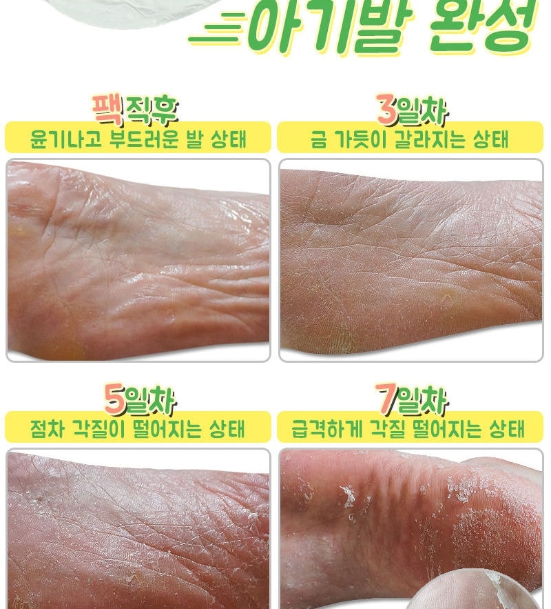 Elizavecca - Witch Piggy Hell Pore Turtle's Foot Pack (40g x 1pair)