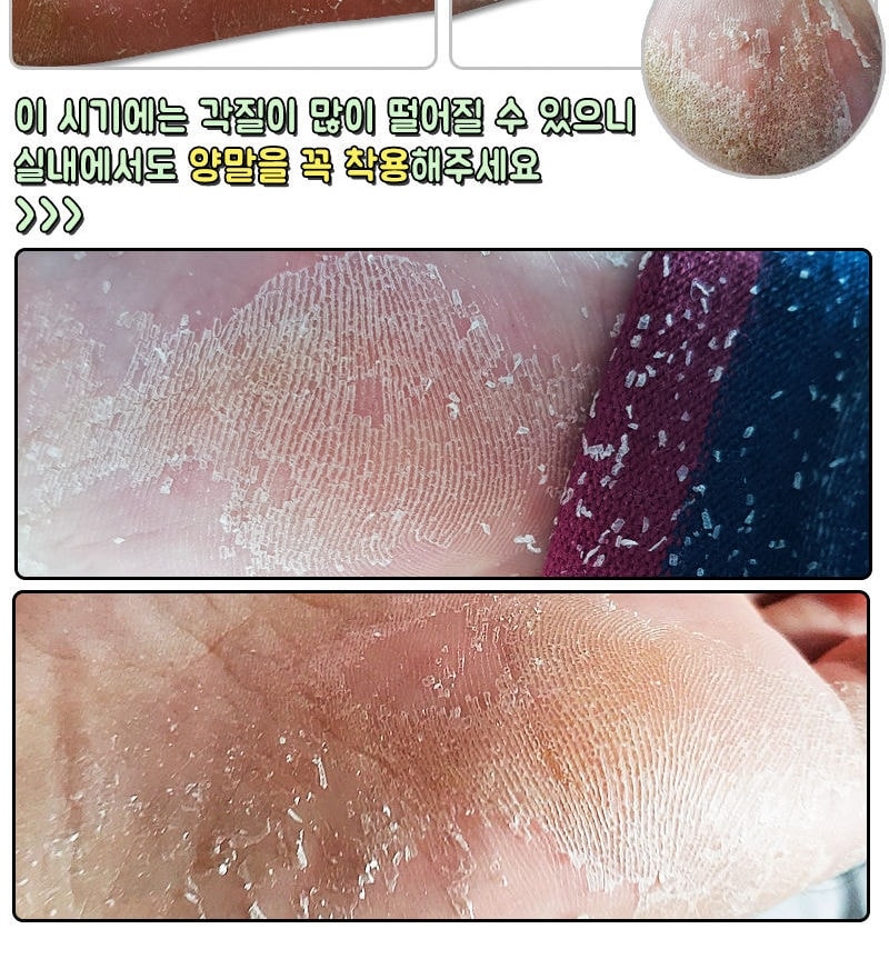 Elizavecca - Witch Piggy Hell Pore Turtle's Foot Pack (40g x 1pair)