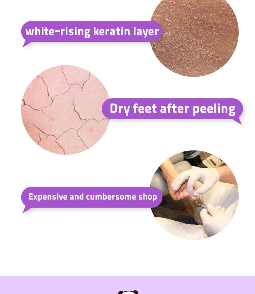 esfolio - 3HA Foot Peeling Mask (20ml x 1 pair)