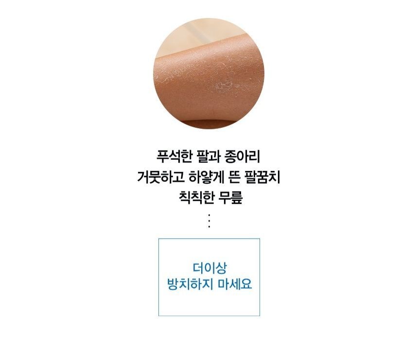 TOSOWOONG - All Kill Exfoliating Gloves