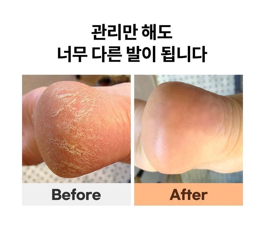 SUNGBOON EDITOR - LHA Baby Foot Scrub Stick (20g)