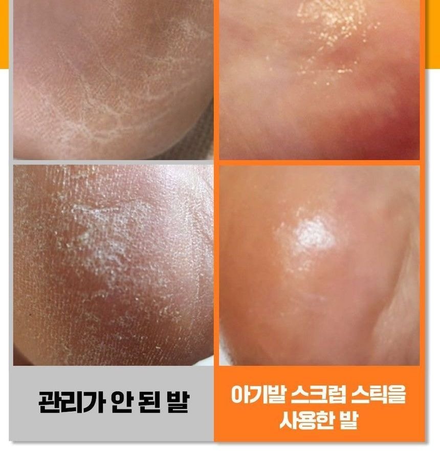 SUNGBOON EDITOR - LHA Baby Foot Scrub Stick (20g)