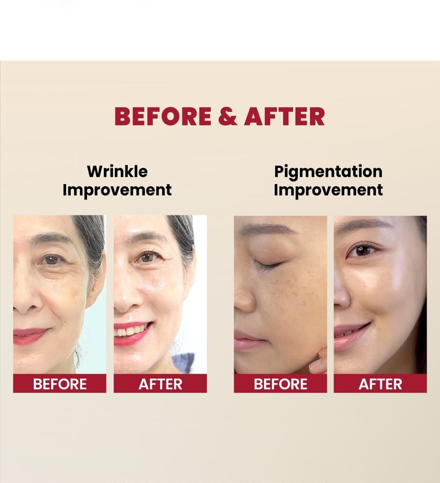 KSECRET - SEOUL 1988 Serum : Retinal Liposome 2% + Black Ginseng