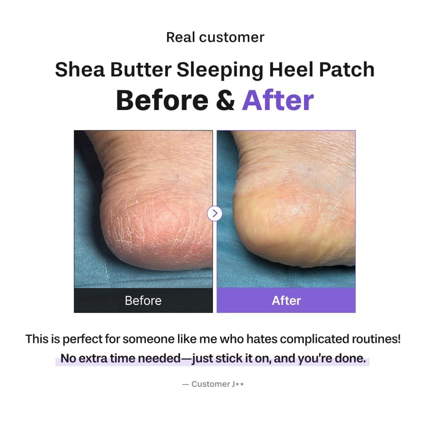 baren - Shea Butter Sleeping Heel Patch 10 pcs