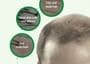 SOME BY MI - Cica Peptide Anti Hair Loss Derma Scalp Tonic