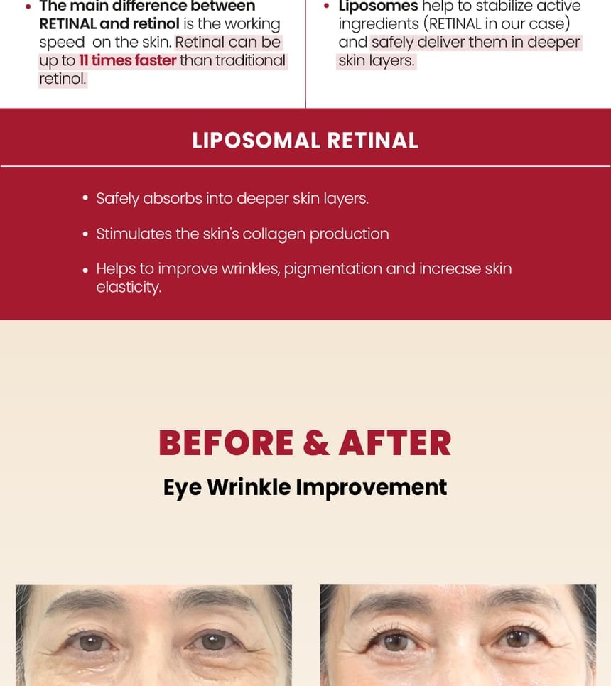 KSECRET - SEOUL 1988 Eye Cream : Retinal Liposome 4% + Fermented Bean