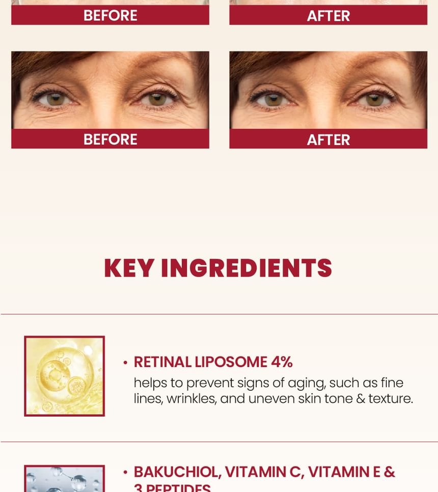 KSECRET - SEOUL 1988 Eye Cream : Retinal Liposome 4% + Fermented Bean