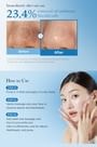 medicube - Zero Pore Blackhead Cleansing Oil