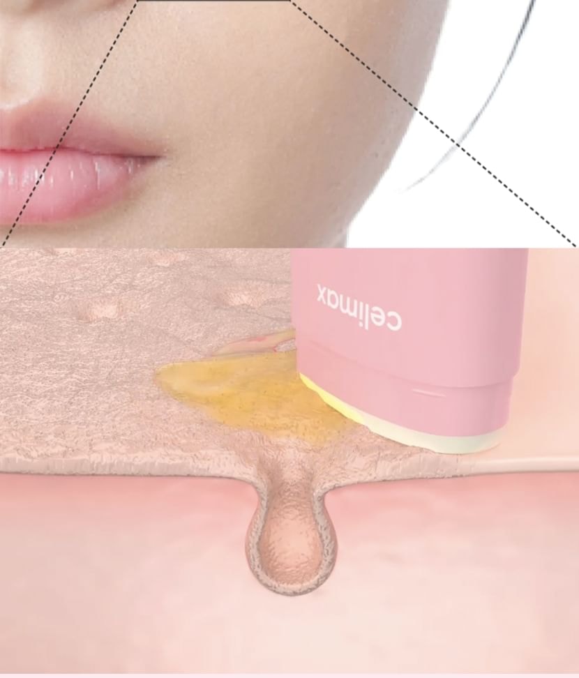 celimax - Oil Control Mattifying Sun Stick