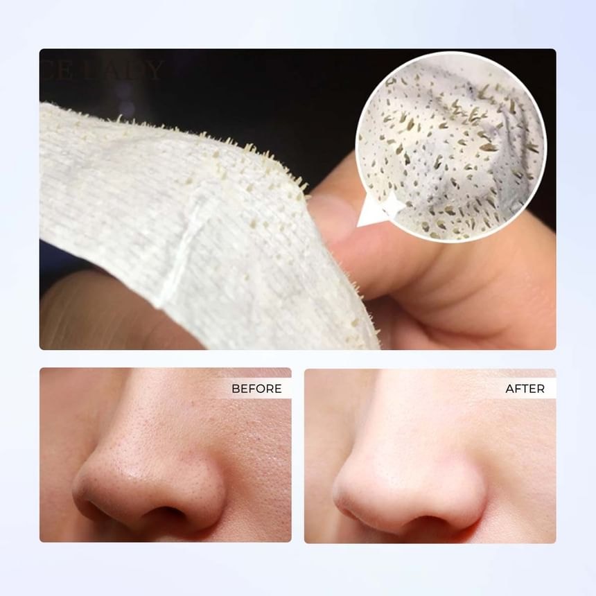 Sace Lady - Deep Cleansing Nose Pores Strips