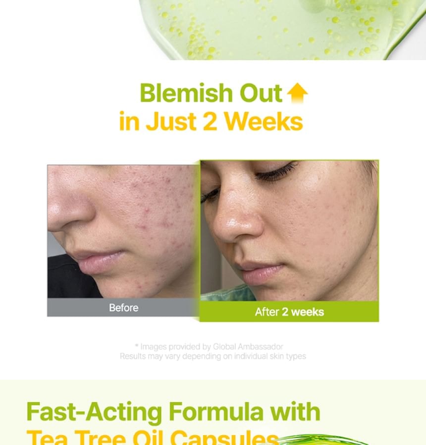 Purito SEOUL - Azelaic Acid 10 Kojic Tea Tree Serum