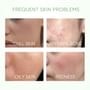 SKINTIFIC - Mugwort Acne Clay Stick