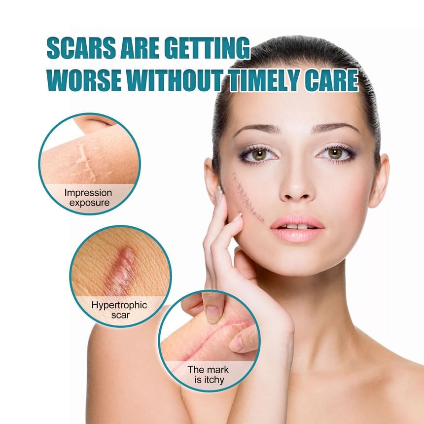 Porcini - Silicone Scar Sheet Tape