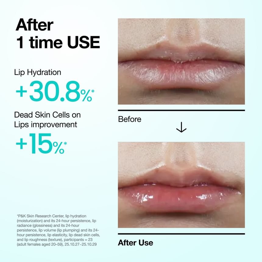 Anua - PDRN Lip Serum