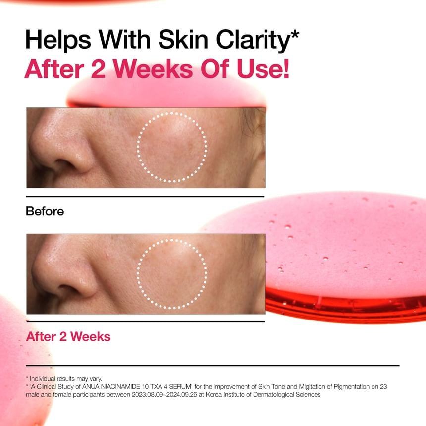 Anua - Niacinamide 10 TXA 4 Serum Mini