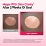 Anua - Niacinamide 10 TXA 4 Serum Set Kpop Demon Hunters Collaboration