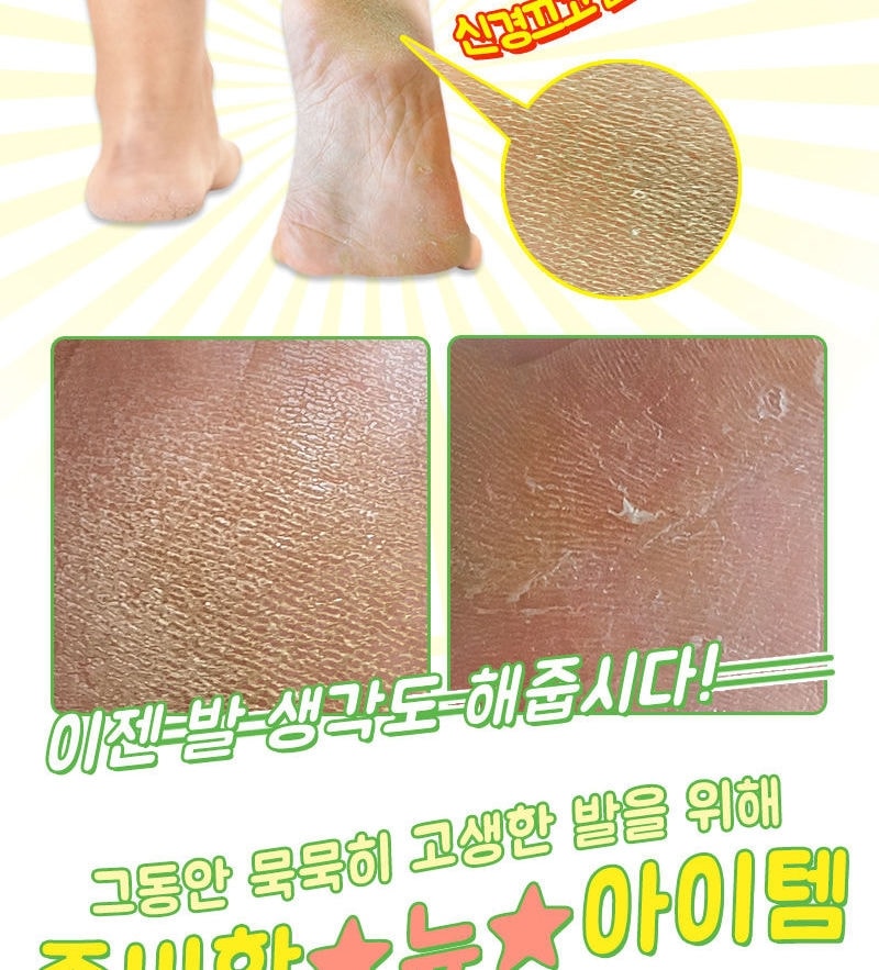 Elizavecca - Witch Piggy Hell Pore Turtle's Foot Pack 10pcs Bundle Set (40g x 1pair x 10 pcs)