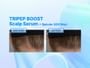 CELDYQUE - Tripep Boost 9-Peptide Energy Scalp Serum 2pcs Bundle Set