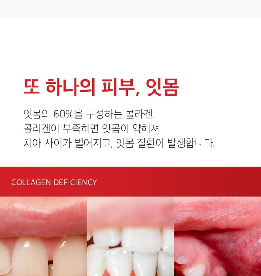 MEDIPEEL - Dentil Gum Toothpaste 5pcs Bundle Set (100g x 5 pcs)