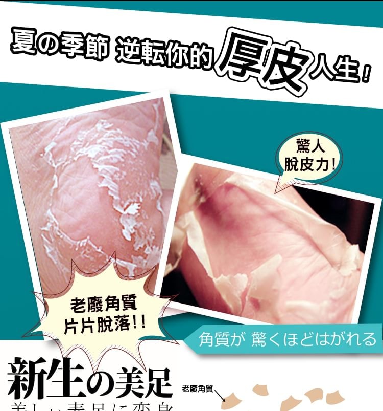 My Scheming - Mint Hard Skin Removal Foot Mask 5pcs Bundle Set (1 pair x 5 pcs)