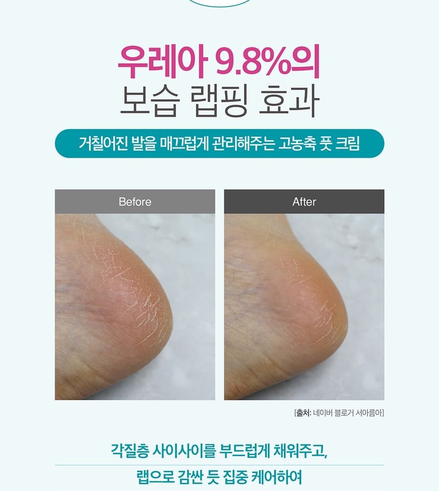 Derma: B - Urea Foot Cream 5pcs Bundle Set (80ml x 5 pcs)