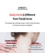 TIA'M - Anti Blemish Body Lotion Back & Chest 2pcs Bundle Set