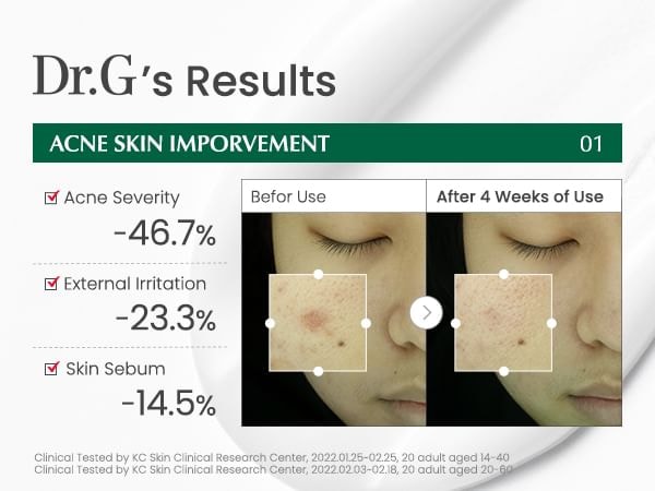 Dr.G - R.E.D Blemish Clear Soothing Cream