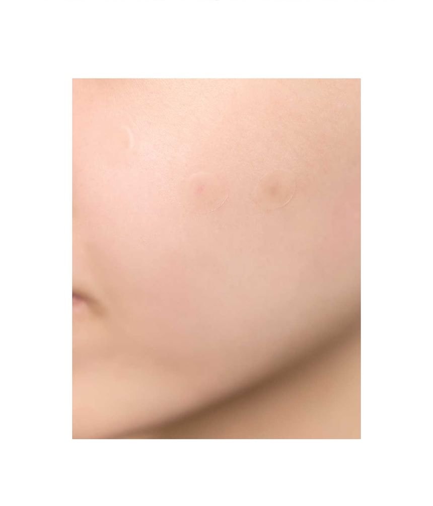 SKIN1004 - Spot Cover Patch