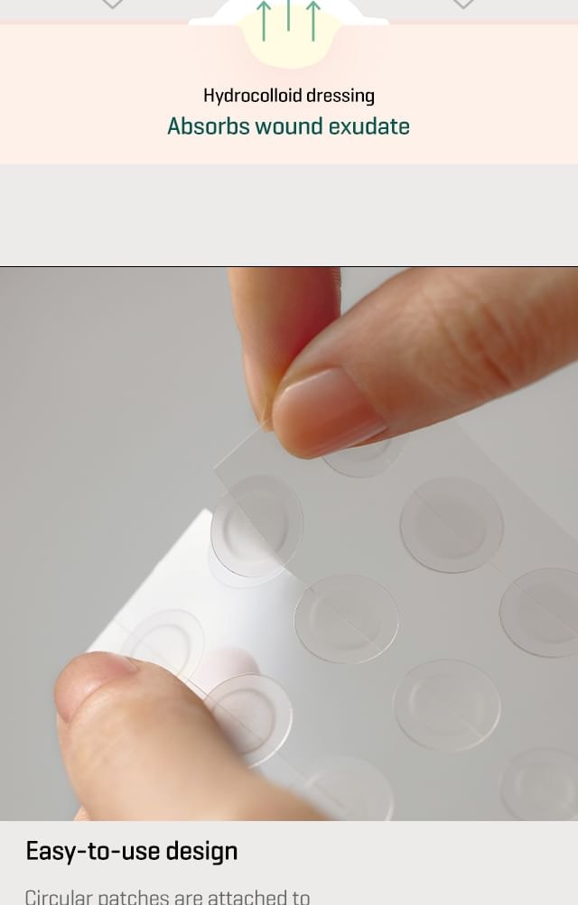 SOME BY MI - 30 Days Miracle Clear Spot Patch