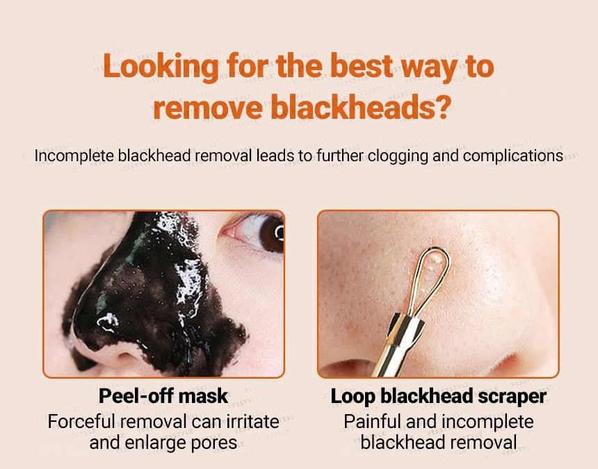 Buttermilk - Blackhead Scraper Remover