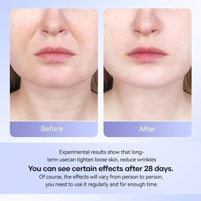 ANLAN - EMS Neck Beauty Device