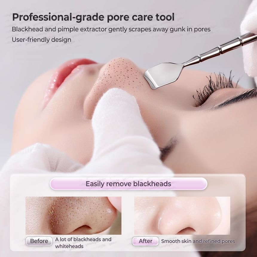 Choyu - Stainless Steel Blackhead Remover / Blotting Paper / Case / Set (Various Designs)