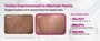 Dr.Melaxin - Picotonic Shot Pigmentation Serum