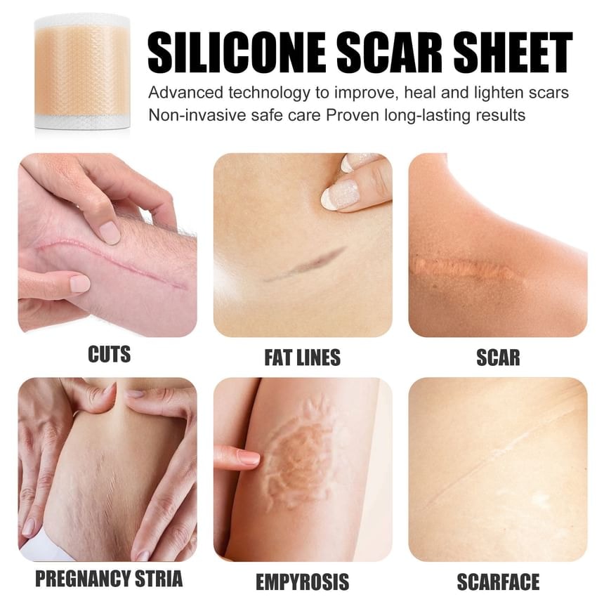 Porcini - Silicone Scar Sheet Tape