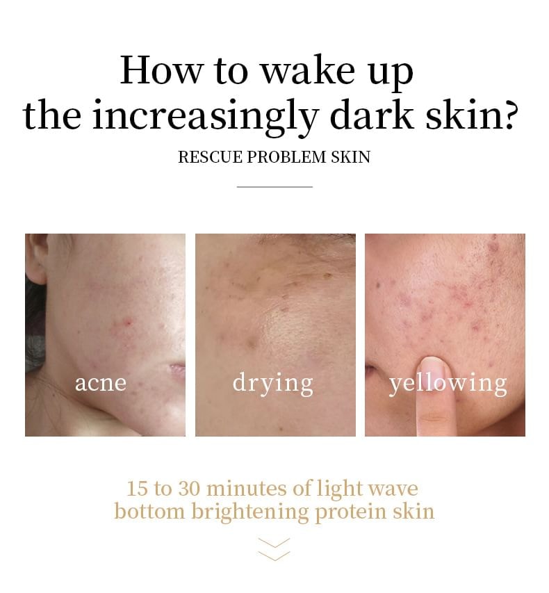 Beautyronics - Light Therapy Face Mask USB Rechargeable
