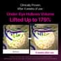 Dr.Melaxin - Cemenrete Calcium Volume Cream