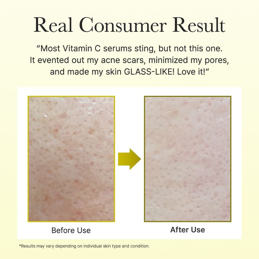 Arencia - Vitamin C Booster Shot Mini