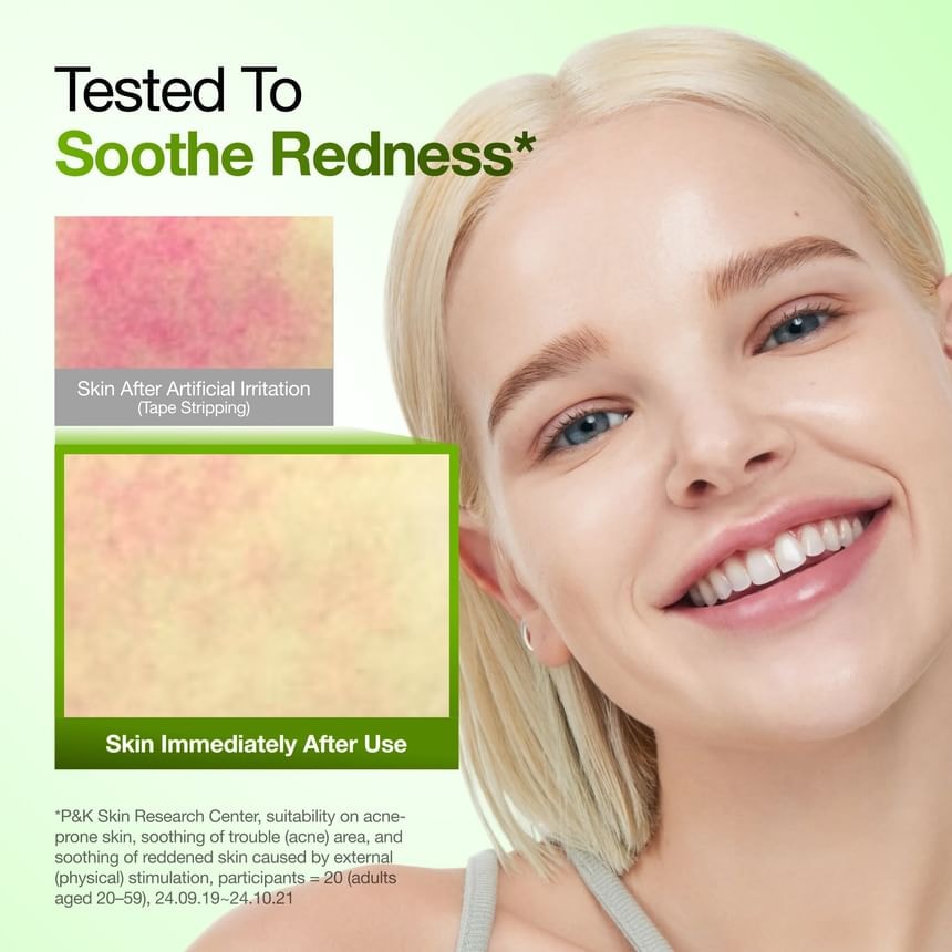 Anua - Azelaic Acid 10 Hyaluron Redness Soothing Serum Set Kpop Demon Hunters Collaboration