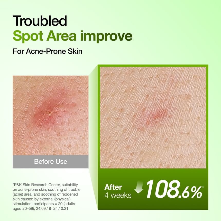 Anua - Azelaic Acid 10 Hyaluron Redness Soothing Serum Set Kpop Demon Hunters Collaboration