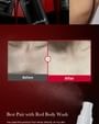 medicube - Red Acne Body Peeling Shot 2pcs Bundle Set
