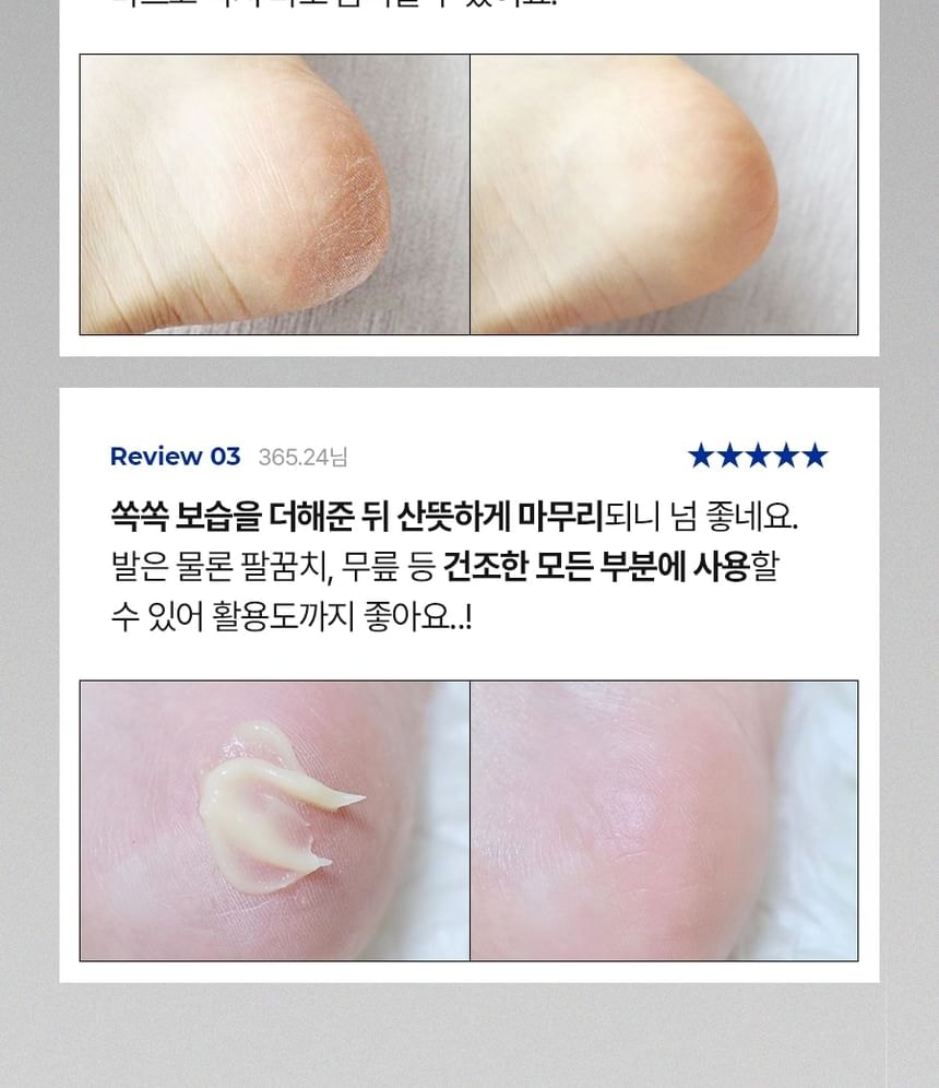 MEDIPEEL - EGF Scaling Moisture Foot Cream 2.0 2pcs Bundle Set (2026 Version - 130g x 2 pcs)