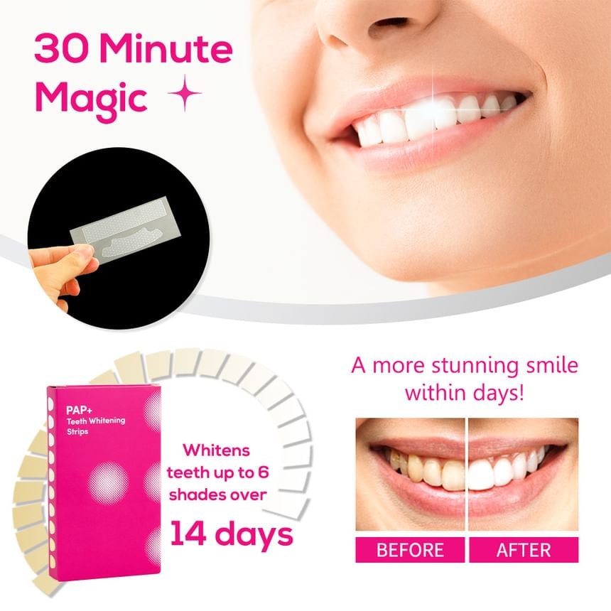GlorySmile - PAP+ Teeth Whitening Strips 5pcs Bundle Set (7 pairs x 5 pcs)