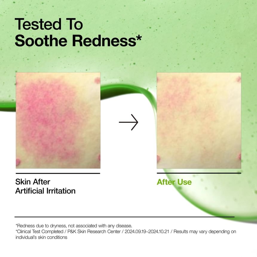 Anua - Azelaic Acid 10 Hyaluron Redness Soothing Serum 2pcs Bundle Set