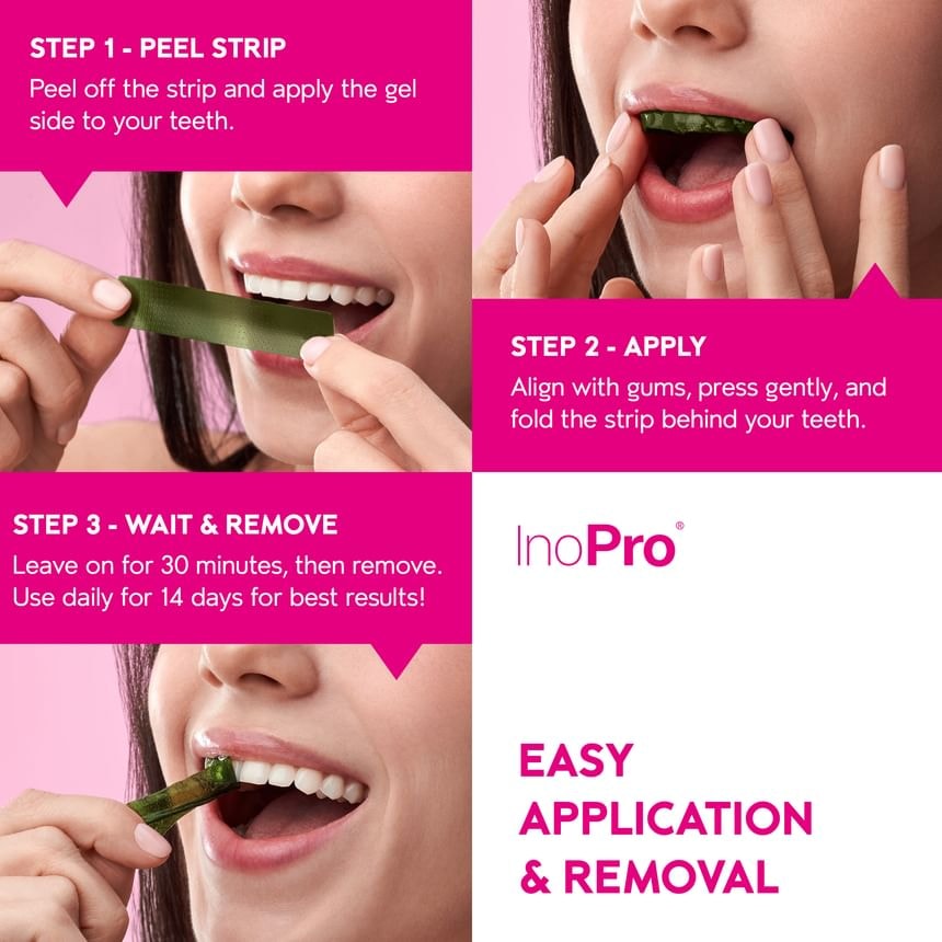 INOPRO - Innovative Whitening Strips (14 treatments/28 strips)