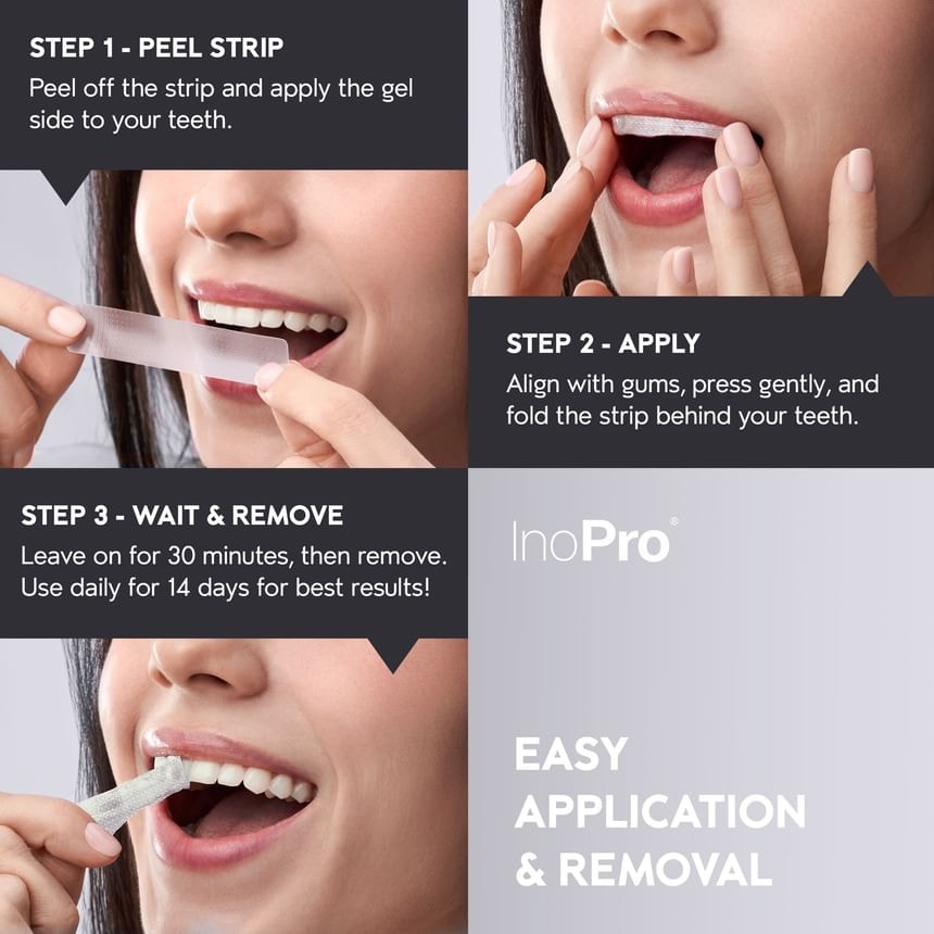 INOPRO - Advanced Whitening Strips (14 treatments/28 strips)